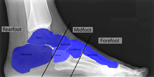 Rear Foot XRay