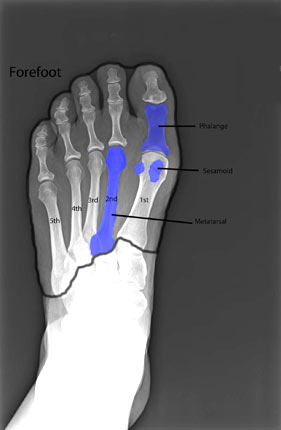 Forefoot XRay