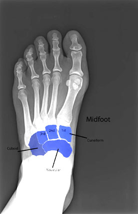 Midfoot XRay