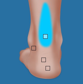 Achilles tendon