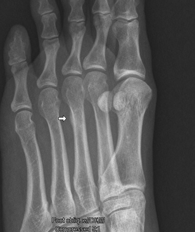 Image alternate description